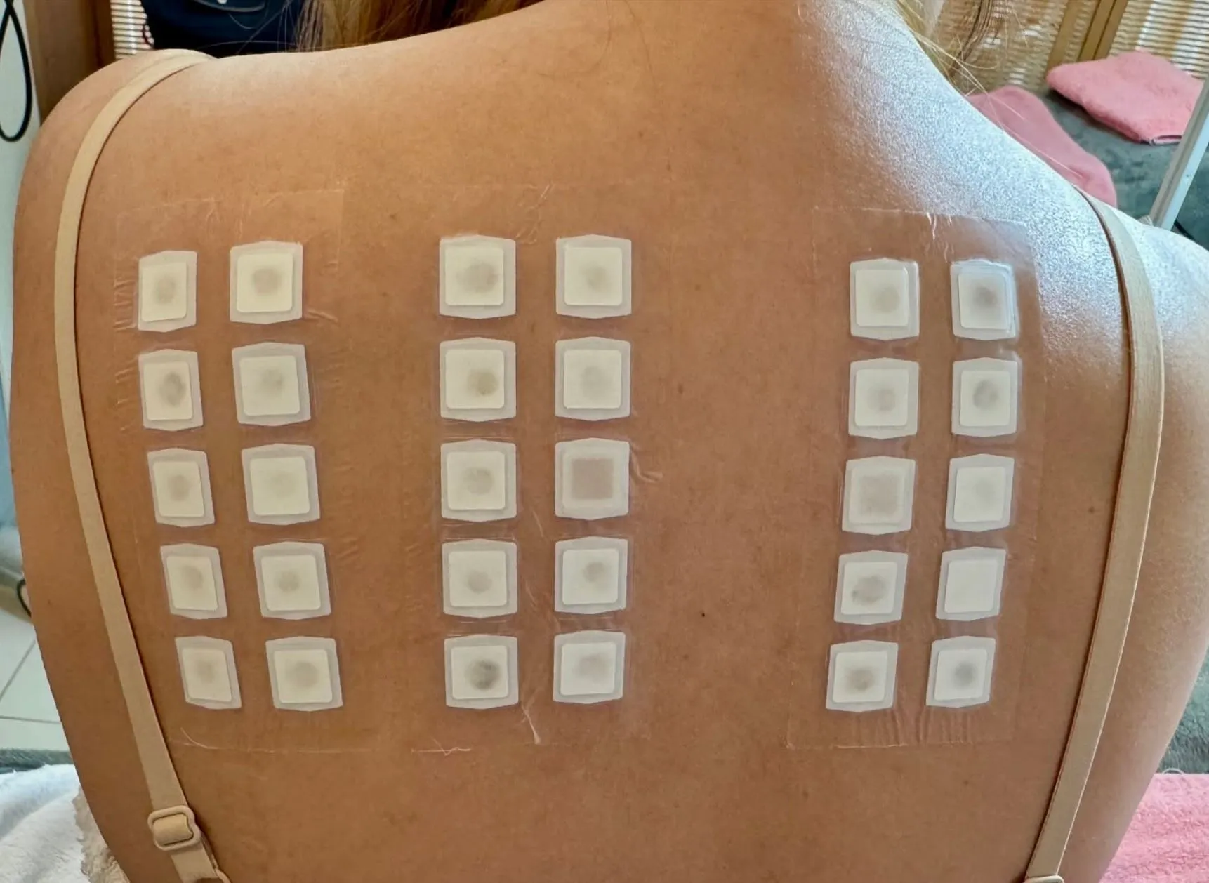 Is a Patch Test Required Before Getting an Eyeliner Tattoo