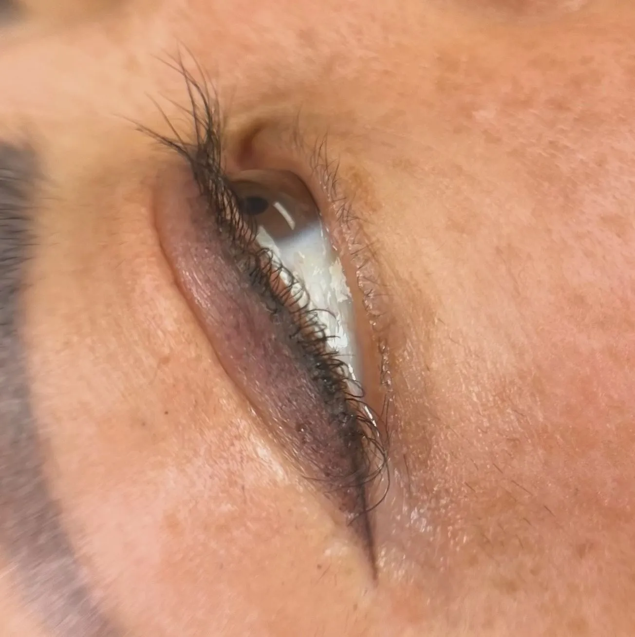 Why Your Eyes Need Extra Care